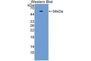 Western blot analysis of the recombinant protein. (KLF10/TIEG1 Antikörper  (AA 1-210))
