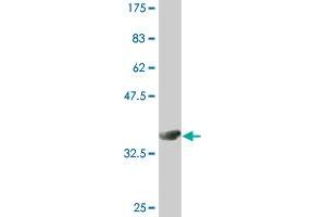 Western Blot detection against Immunogen (36. (RAB5 Antikörper  (AA 116-215))