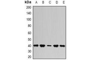 Western blot analysis of PSAT1 expression in Hela (A), SKOV3 (B), mouse kidney (C), mouse thymus (D), rat brain (E) whole cell lysates. (PSAT1 Antikörper)