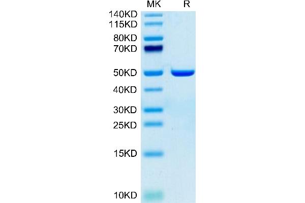 Aspartate beta Hydroxylase Protein (AA 341-758) (His tag)