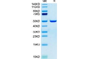 Human ASPH on Tris-Bis PAGE under reduced condition. (Aspartate beta Hydroxylase Protein (AA 341-758) (His tag))