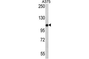 Western blot analysis of PALA Antibody (N-term) in A375 cell line lysates (35ug/lane). (TECPR1 / PALA (N-Term) Antikörper)