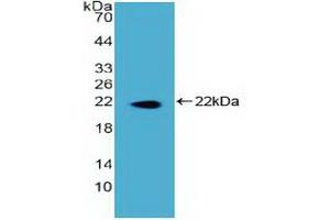 Figure. (DKC1 Antikörper  (AA 298-465))