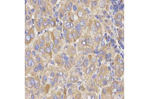 Immunohistochemistry (IHC) image for anti-Kinesin Light Chain 1 (KLC1) antibody (ABIN1876732) (KLC1 Antikörper)