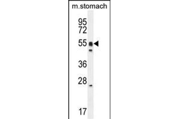 DMRTA1 Antikörper  (C-Term)