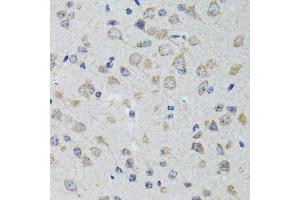 Immunohistochemistry of paraffin-embedded rat brain using HTR3A antibody. (Serotonin Receptor 3A Antikörper  (AA 24-241))