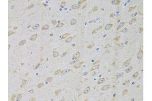 Immunohistochemistry of paraffin-embedded mouse brain using GARS antibody (ABIN5973156) at dilution of 1/100 (40x lens). (GARS Antikörper)