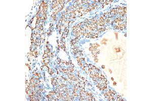 Immunohistochemistry of paraffin-embedded rat ovary using CYPOR Rabbit mAb (ABIN7269151) at dilution of 1:100 (40x lens). (POR Antikörper)