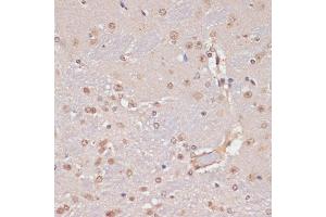Immunohistochemistry of paraffin-embedded mouse brain using PIDD antibody (ABIN1680710, ABIN3019230, ABIN3019231, ABIN5664897 and ABIN6220775) at dilution of 1:100 (40x lens). (PIDD Antikörper  (AA 1-85))