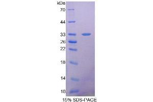 SDS-PAGE analysis of Mouse SDHA Protein. (SDHA Protein)