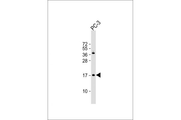 NDUFAF3 Antikörper  (N-Term)