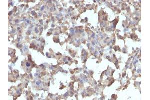Image no. 1 for anti-Tumor Necrosis Factor alpha (TNF alpha) antibody (ABIN6171941) (TNF alpha Antikörper)
