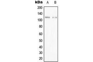 Western blot analysis of PPFIBP1 expression in Jurkat (A), HEK293T (B) whole cell lysates. (PPFIBP1 Antikörper  (Center))