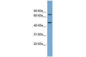 Western Blotting (WB) image for anti-Angiogenic Factor with G Patch and FHA Domains 1 (AGGF1) (Middle Region) antibody (ABIN2787060)