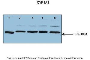 Western Blotting (WB) image for anti-Cytochrome P450, Family 1, Subfamily A, Polypeptide 1 (CYP1A1) (Middle Region) antibody (ABIN2776793)