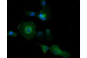 Image no. 1 for anti-Phosphatidylinositol-4-Phosphate 3-Kinase, Catalytic Subunit Type 2 beta (PIK3C2B) antibody (ABIN1500198) (PIK3C2B Antikörper)