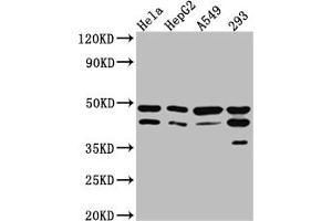 Western Blot Positive WB detected in: Hela whole cell lysate, HepG2 whole cell lysate, A549 whole cell lysate, 293 whole cell lysate All lanes: GSK3 beta Antibody at 1:1000 Secondary Goat polyclonal to rabbit IgG at 1/50000 dilution Predicted band size: 47, 49 kDa Observed band size: 47 kDa