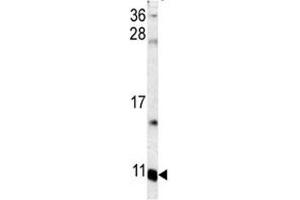 Western Blotting (WB) image for anti-S100 Calcium Binding Protein A6 (S100A6) (AA 37-67) antibody (ABIN3032513)