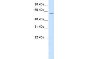 Western Blotting (WB) image for anti-Homeobox D3 (HOXD3) antibody (ABIN2461608) (HOXD3 Antikörper)