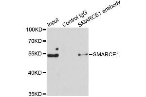 Immunoprecipitation analysis of 150ug extracts of Jurkat cells using 3ug SMARCE1 antibody (ABIN6290090). (SMARCE1 Antikörper)