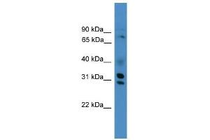 GIPC3 antibody used at 0. (GIPC3 Antikörper  (Middle Region))