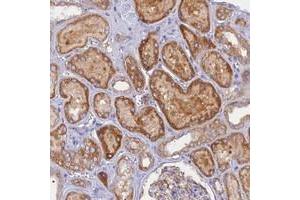 Immunohistochemical staining of human kidney with CACNA1B polyclonal antibody  shows strong cytoplasmic positivity in cells in tubules.