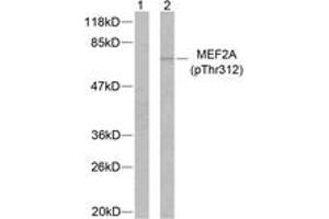 Western blot analysis of extracts from NIH-3T3 cells treated with PMA, using MEF2A (Phospho-Thr312) Antibody. (MEF2A Antikörper  (pThr312))