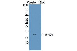 Western blot analysis of recombinant Human DRD1. (Dopamine Receptor d1 Antikörper  (AA 338-446))