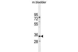 C17orf59 Antibody (Center) western blot analysis in mouse bladder tissue lysates (35µg/lane). (C17orf59 Antikörper  (Middle Region))