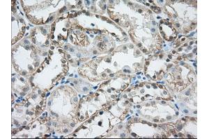 Immunohistochemical staining of paraffin-embedded Human liver tissue using anti-MTRF1L mouse monoclonal antibody. (MTRF1L Antikörper)