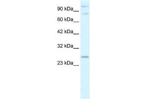 WB Suggested Anti-PCGF3 Antibody Titration:  2. (PCGF3 Antikörper  (Middle Region))