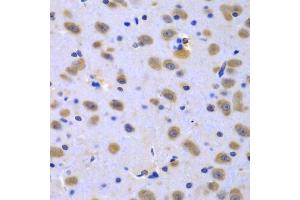 Immunohistochemistry of paraffin-embedded rat brain using CIAO1 antibody (ABIN5975509) at dilution of 1/100 (40x lens). (CIAO1 Antikörper)