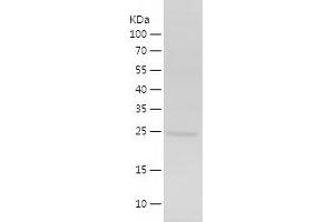 ING4 Protein (AA 1-199) (His tag)