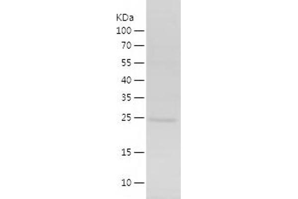 ING4 Protein (AA 1-199) (His tag)