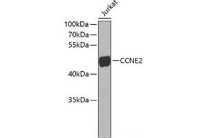 Western blot analysis of extracts of Jurkat cells using CCNE2 Polyclonal Antibody. (Cyclin E2 Antikörper)