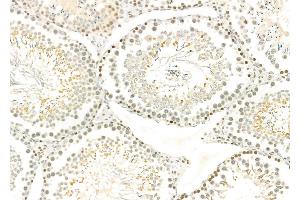 ABIN6259574 and ABIN6275790 at 1/100 staining Rat testis tissue by IHC-P. (CSRNP3 Antikörper  (Internal Region))