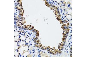 Immunohistochemistry of paraffin-embedded mouse lung using ESD antibody. (Esterase D Antikörper  (AA 1-282))