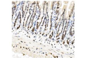 IHC analysis of HP1 alpha/CBX5 using anti-HP1 alpha/CBX5 antibody (ABIN7599058). (CBX5 Antikörper  (AA 1-191))