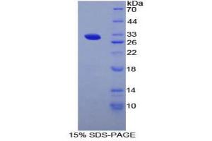SDS-PAGE (SDS) image for Arginyl Aminopeptidase (Aminopeptidase B) (RNPEP) (AA 112-358) protein (His tag) (ABIN2124062) (RNPEP Protein (AA 112-358) (His tag))
