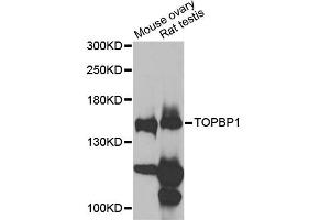 Western blot analysis of extracts of various cell lines, using TOPBP1 antibody (ABIN6291479) at 1:1000 dilution.