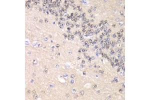 Immunohistochemistry of paraffin-embedded rat brain using CCNC antibody at dilution of 1:100 (x40 lens). (Cyclin C Antikörper)