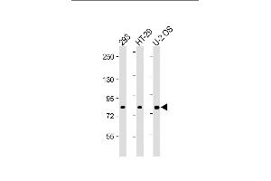All lanes : Anti-ADD1 Antibody (Center) at 1:2000 dilution Lane 1: 293 whole cell lysate Lane 2: HT-29 whole cell lysate Lane 3: U-2 OS whole cell lysate Lysates/proteins at 20 μg per lane. (alpha Adducin Antikörper  (AA 428-462))