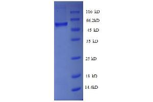 SDS-PAGE (SDS) image for ATPase, H+ Transporting, Lysosomal 31kDa, V1 Subunit E1 (ATP6V1E1) (AA 2-224), (partial) protein (GST tag) (ABIN1607975)