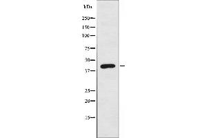 Western blot analysis of extracts from Jurkat cells, using BLZF1 antibody. (BLZF1 Antikörper  (N-Term))