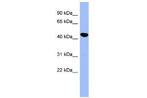 Western Blotting (WB) image for anti-serpin Peptidase Inhibitor, Clade E (Nexin, Plasminogen Activator Inhibitor Type 1), Member 2 (SERPINE2) (Middle Region) antibody (ABIN2786838)