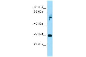 Host:  Rabbit  Target Name:  Prrx1  Sample Type:  Rat Pancreas lysates  Antibody Dilution:  1. (PRRX1 Antikörper  (C-Term))