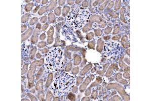 IHC analysis of p57 Kip2/CDKN1C using anti-p57 Kip2/CDKN1C antibody (ABIN7603232).