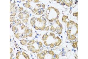 Immunohistochemistry of paraffin-embedded Human stomach using B9D1 Polyclonal Antibody at dilution of 1:100 (40x lens). (B9D1 Antikörper)