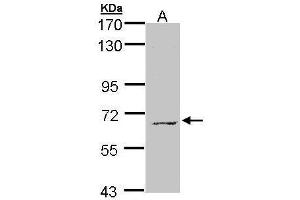 Western Blotting (WB) image for anti-Membrane Protein, Palmitoylated 3 (MAGUK P55 Subfamily Member 3) (MPP3) (Center) antibody (ABIN2856515)