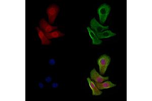 Phospho-p53 (Ser33) Antibody staining Hela cells(heat shock treatment) by IF/ICC.
